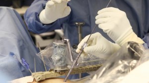 Israeli spinal surgery company Mazor Robotics sold for $1.6 billion article image