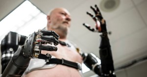 Robotics prosthetics market set to soar article image